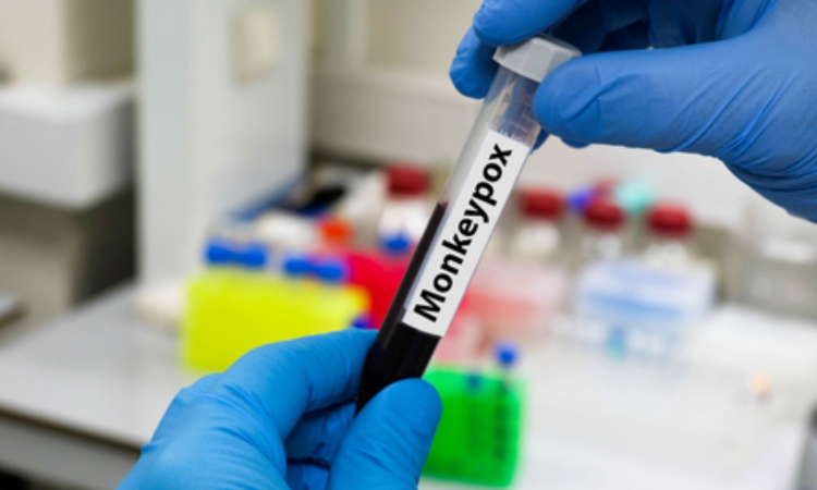 Africa CDC urges aggressive action to curb mpox outbreak in southern Ethiopia Africa CDC urges aggressive action to curb mpox outbreak in southern Ethiopia