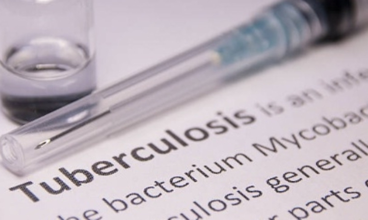 Researchers develop portable device that detects TB using smartphones
