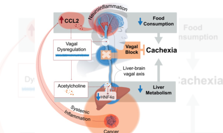 Study identifies reasons behind deadly weight loss in cancer patients